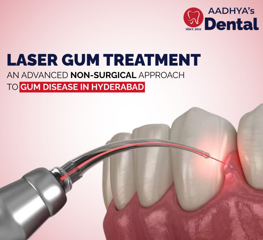 Laser Gum Treatment: An Advanced Non-Surgical Approach to Gum Disease in Hyderabad