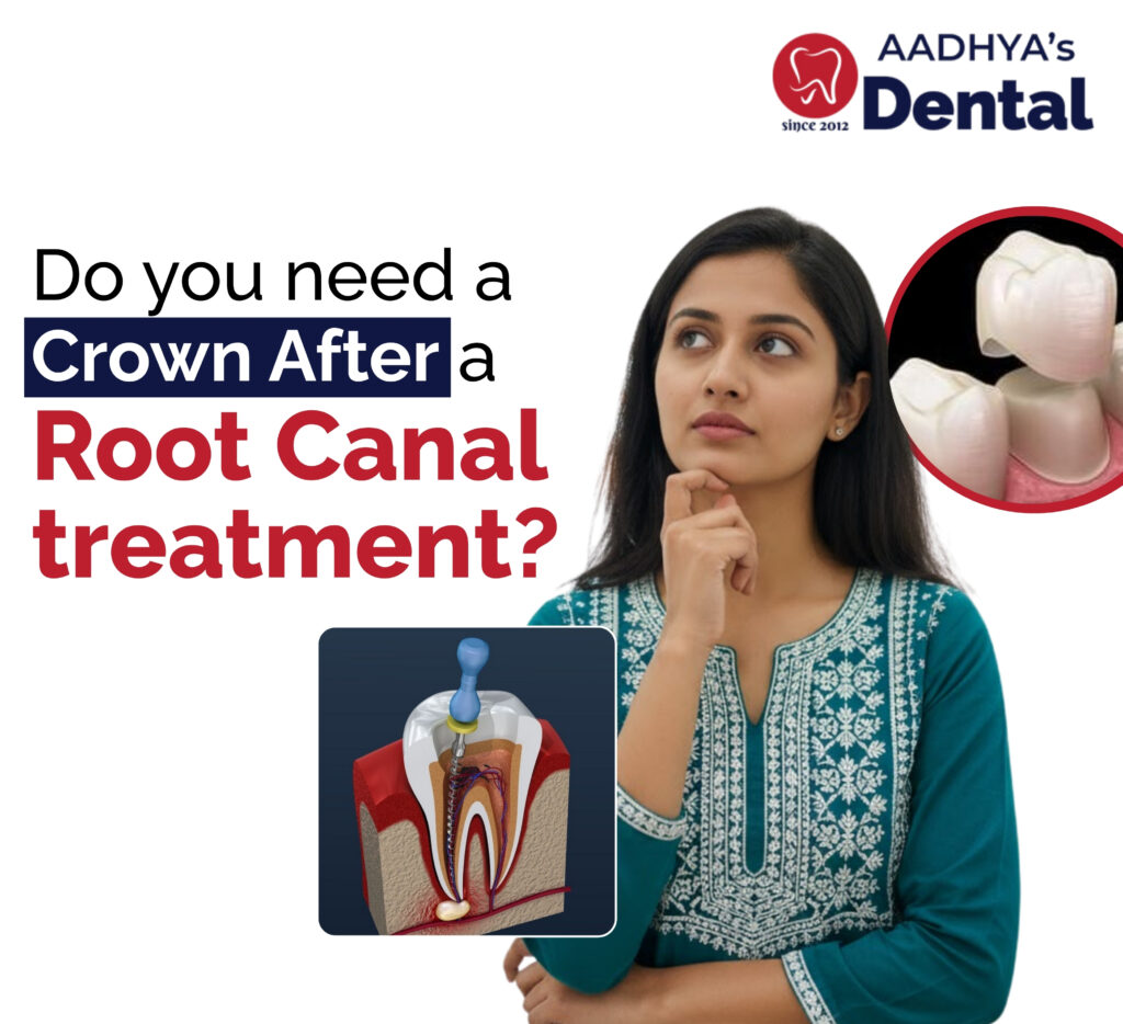 root canal treatment