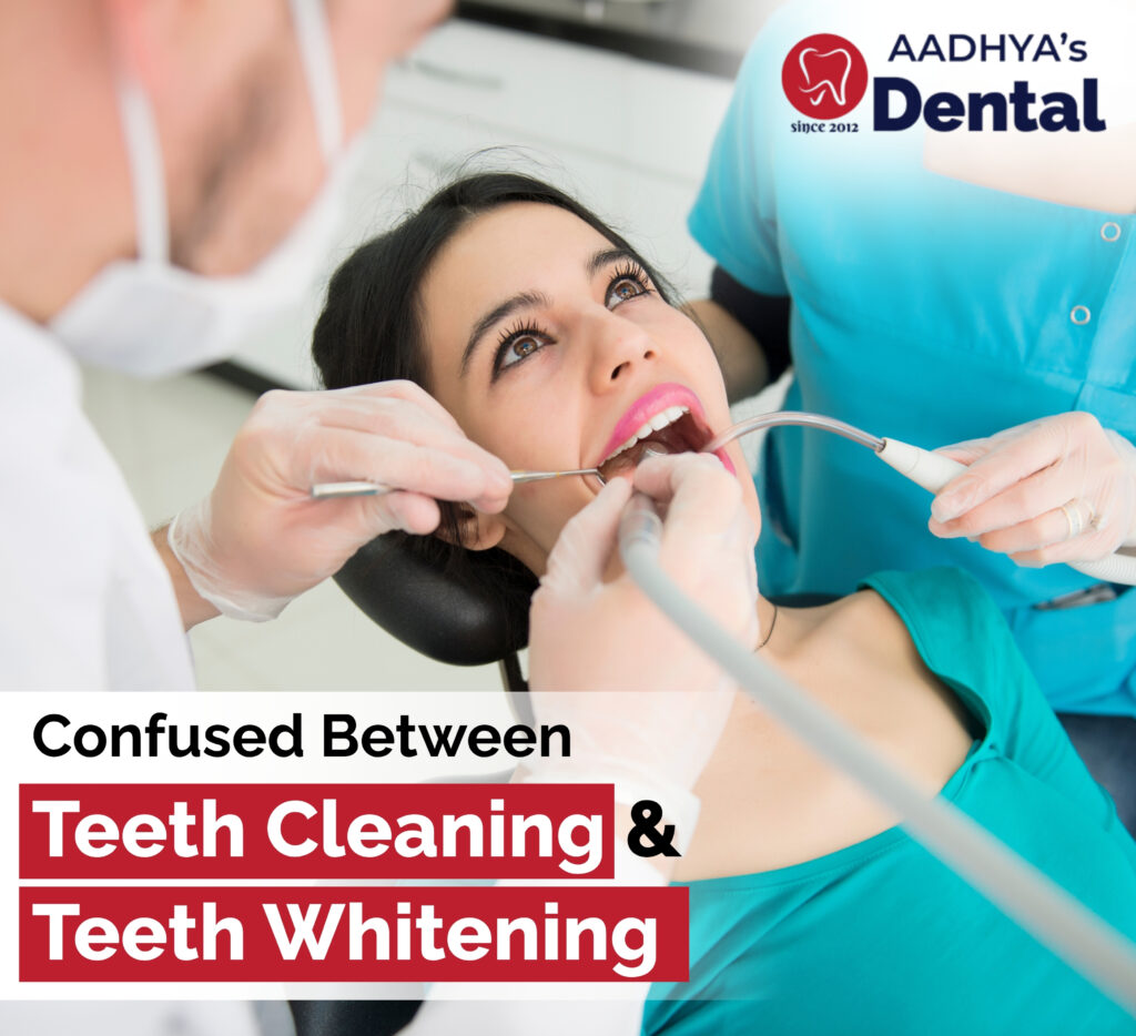 Professional whitening treatments