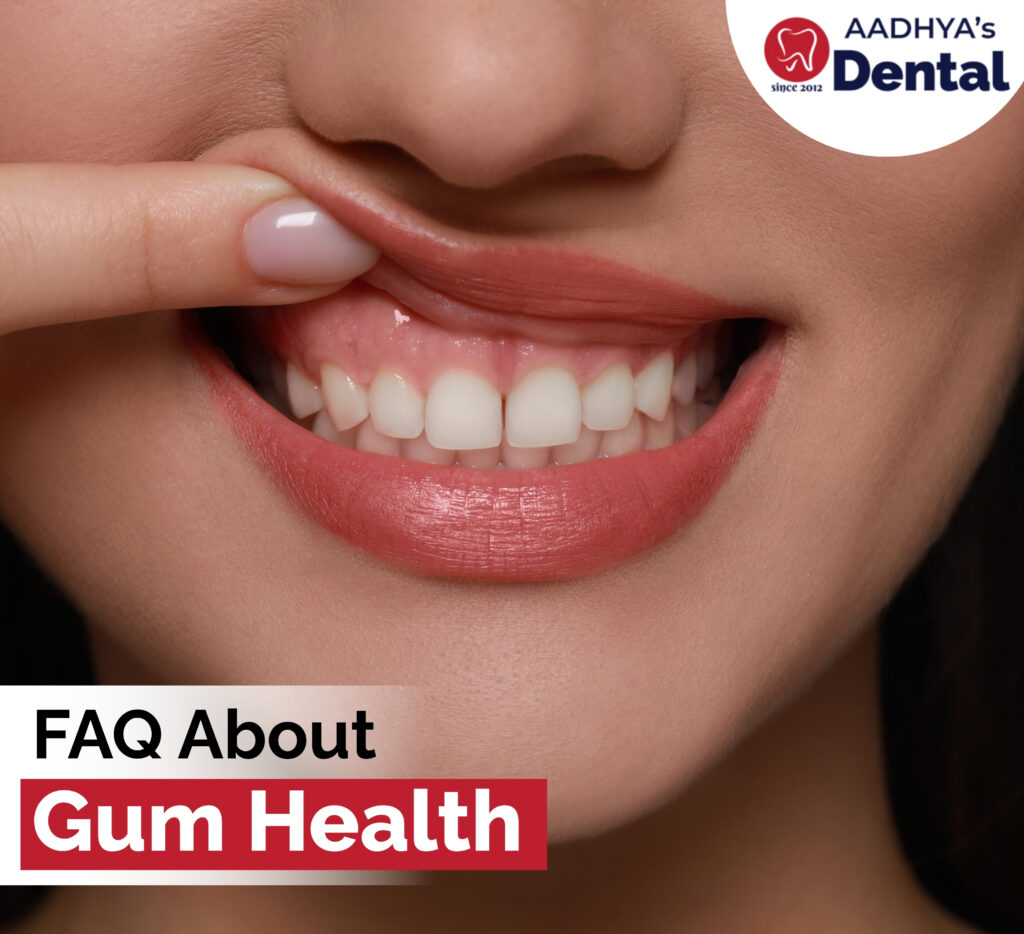 FAQ About Gum Health