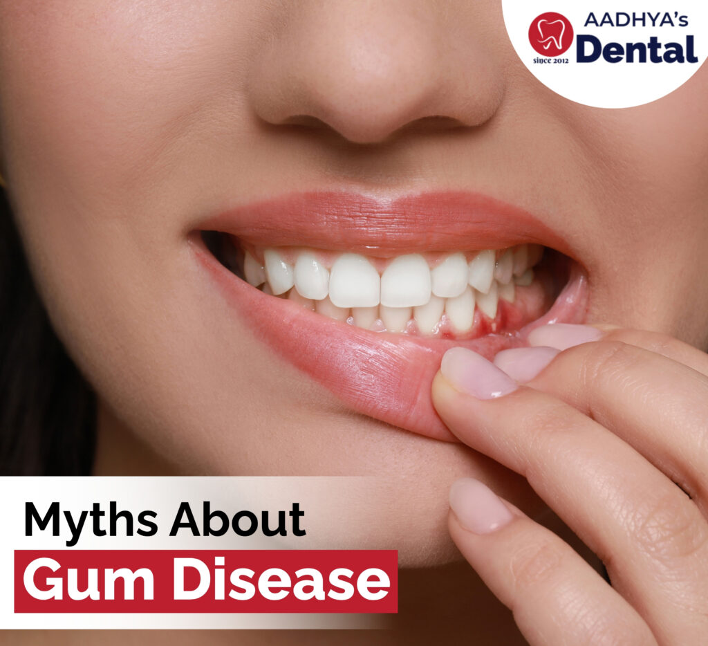 gum disease treatment in nallagandla