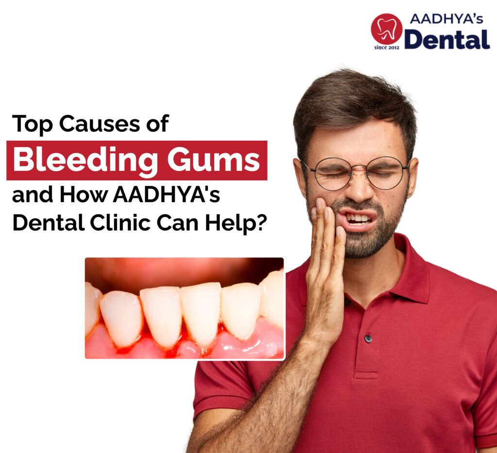 bleeding gums treatment in nallagandla