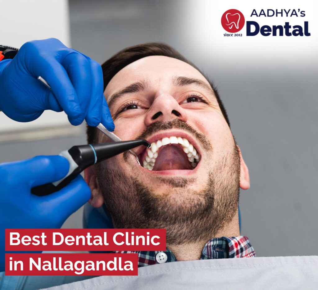 Best Dental clinic in Nallagandla
