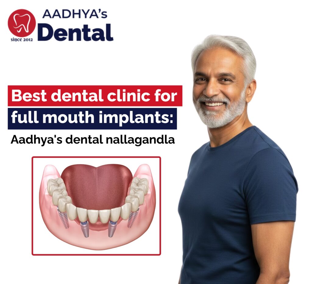 full mouth dental implants in Hyderabad