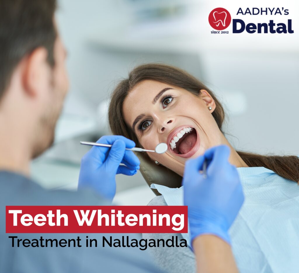 Teeth Whitening Treatment in Nallagandla