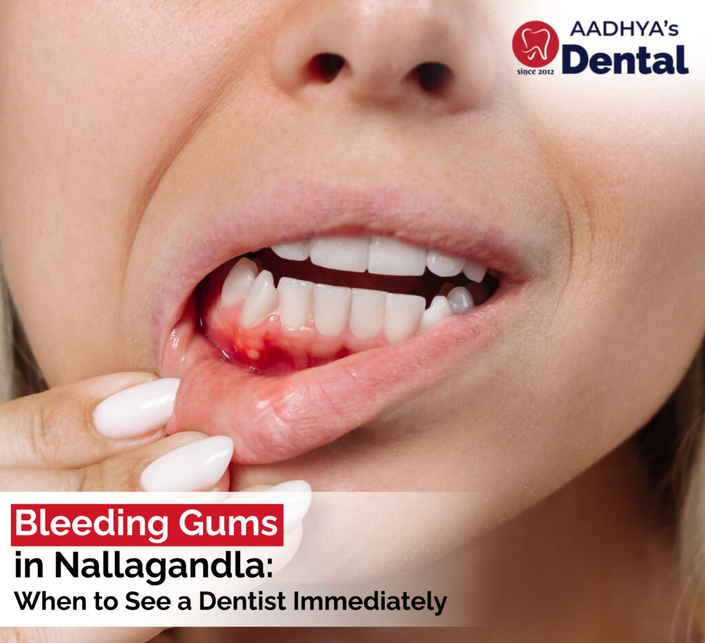 bleeding gums treatment