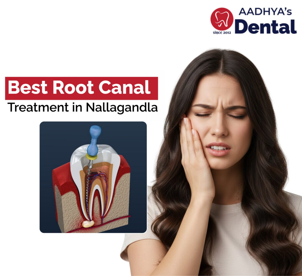 Root Canal Treatment in Nallagandla