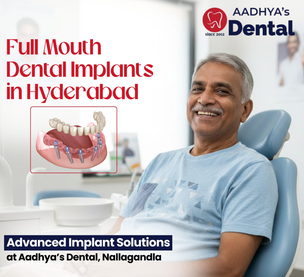full mouth dental implants in Hyderabad