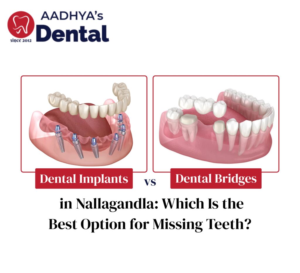 Dental Implants vs Bridges in Nallagandla