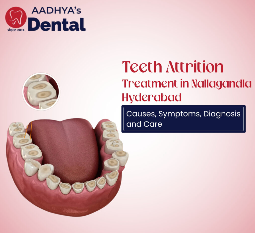 Teeth Attrition Treatment in Nallagandla