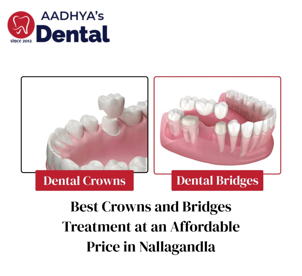 dental crowns and bridges