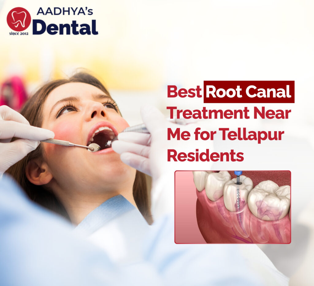 best root canal treatment near me for Tellapur