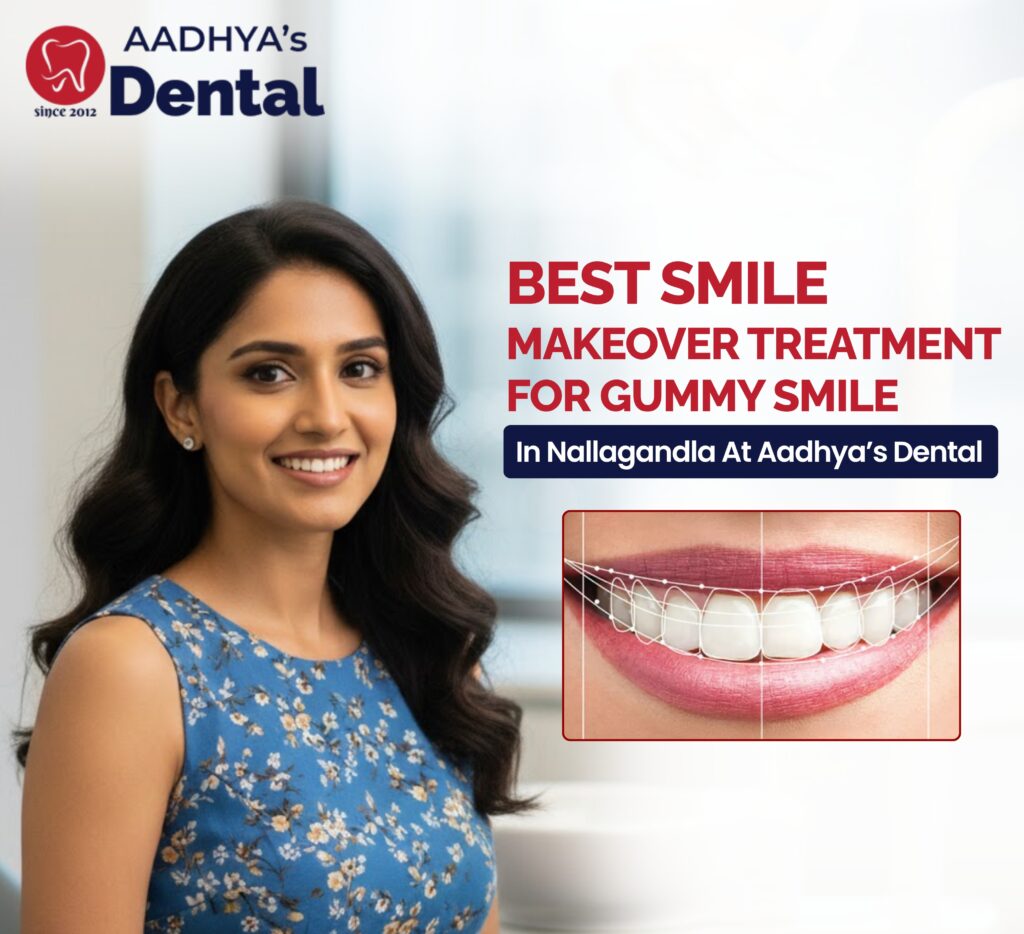 Gummy Smile Treatment in Nallagandla