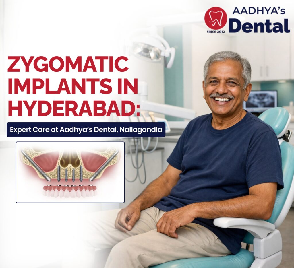 Zygomatic Implants in Hyderabad