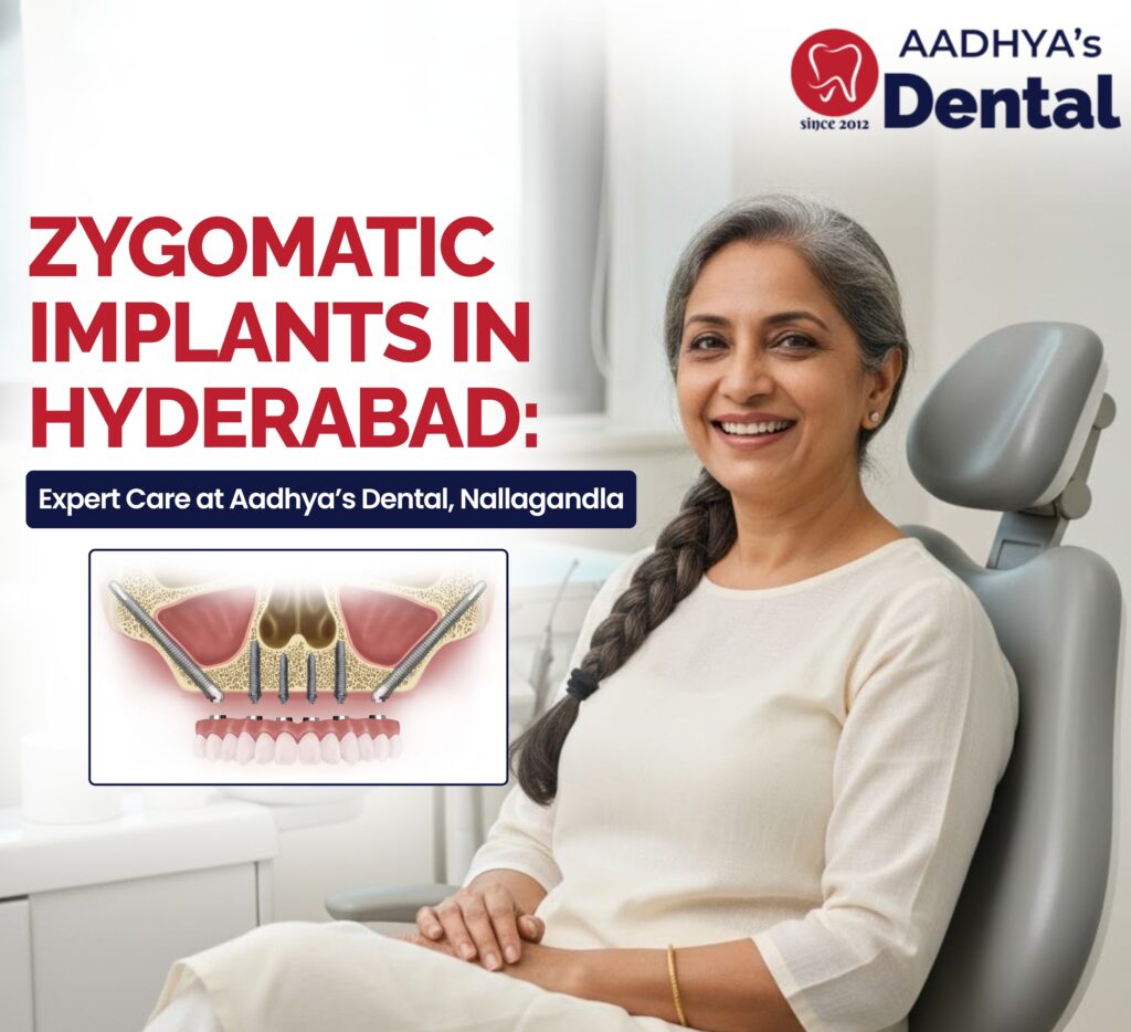 Zygomatic Dental Implants in Hyderabad