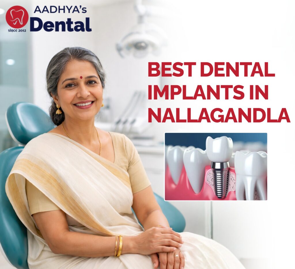 best dental implants in Nallagandla