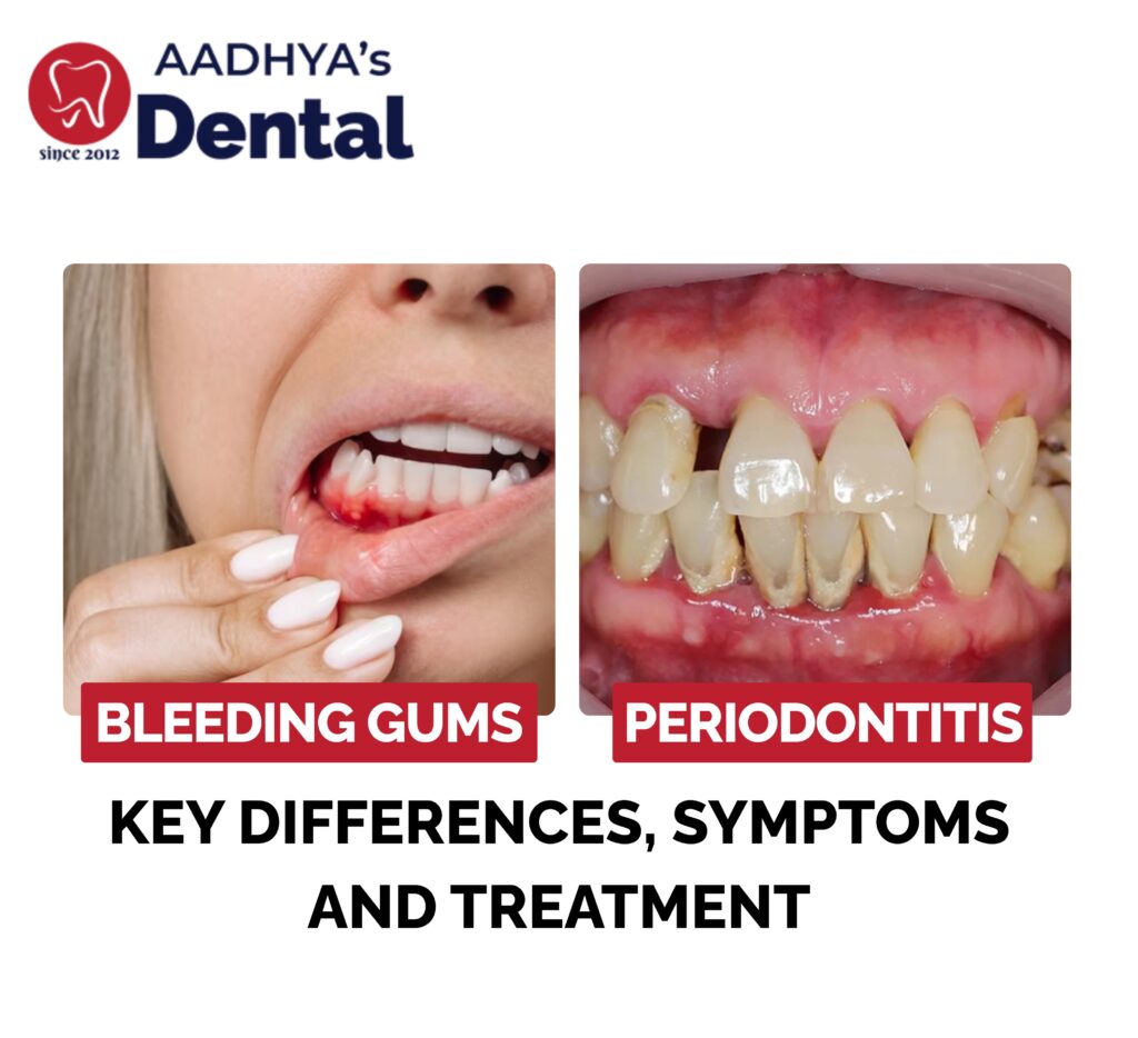 Gum disease treatment in Nallagandla