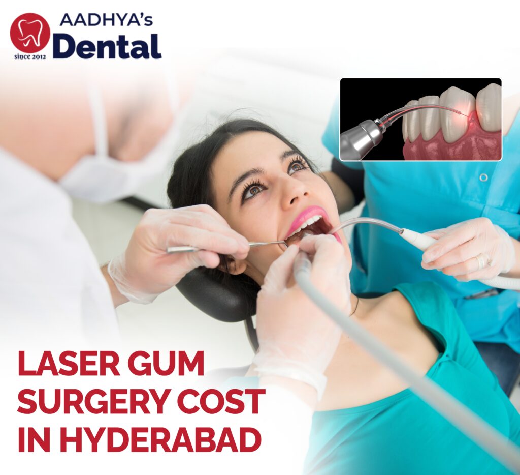 Laser Gum Surgery Cost in Hyderabad