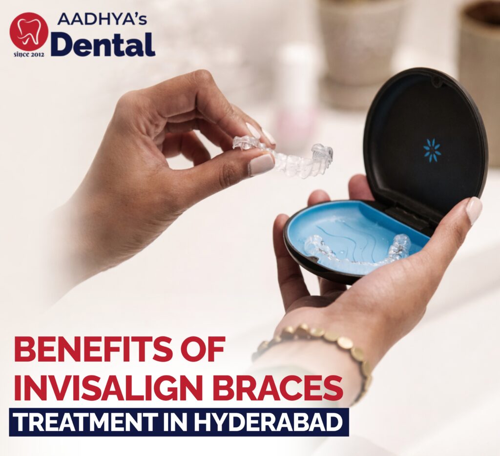 Invisalign braces treatment in Hyderabad