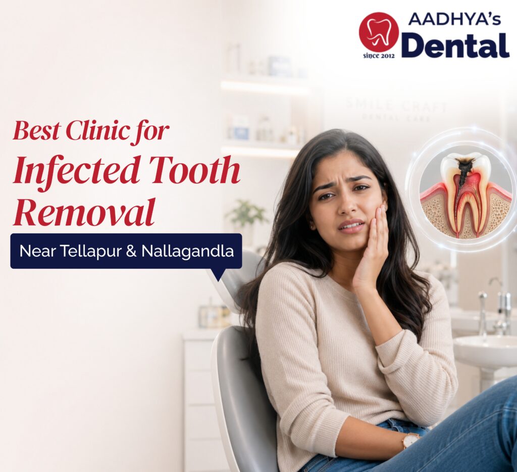 Best Clinic for Infected Tooth Removal Near Tellapur