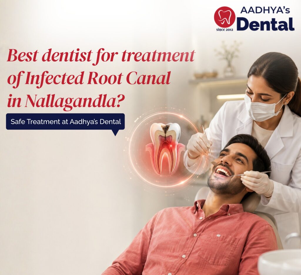 Best dentist for treatment of Infected Root Canal in Nallagandla