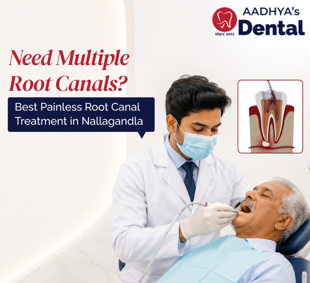 Best Painless Root Canal Treatment in Nallagandla