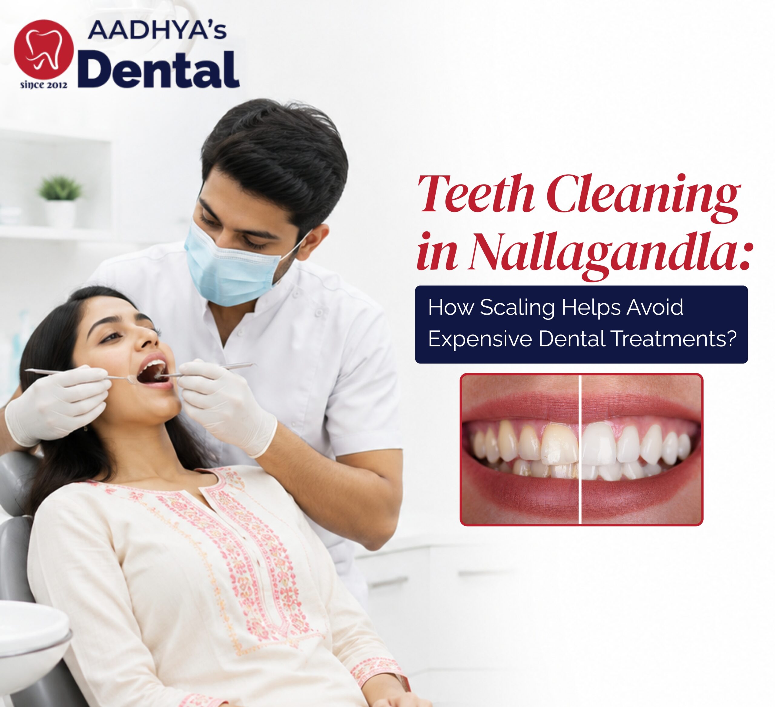 Teeth Cleaning in Nallagandla