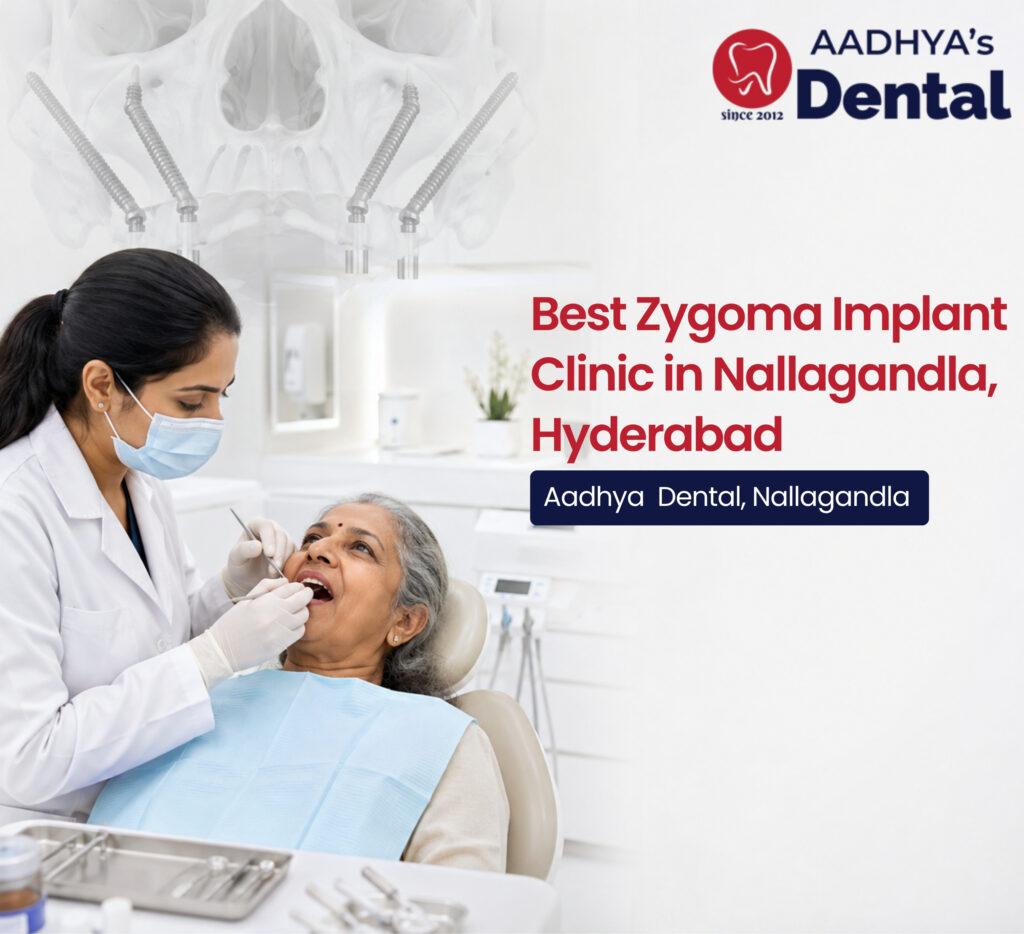 zygoma implant clinic in Nallagandla