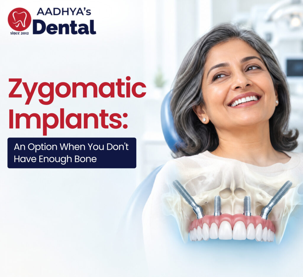 Zygomatic implants in nallagandla
