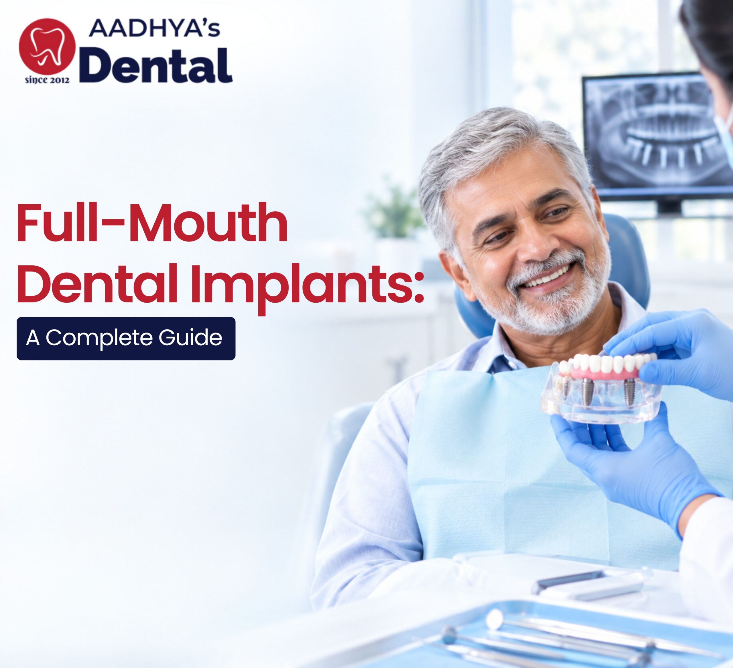 Full-Mouth Dental Implants