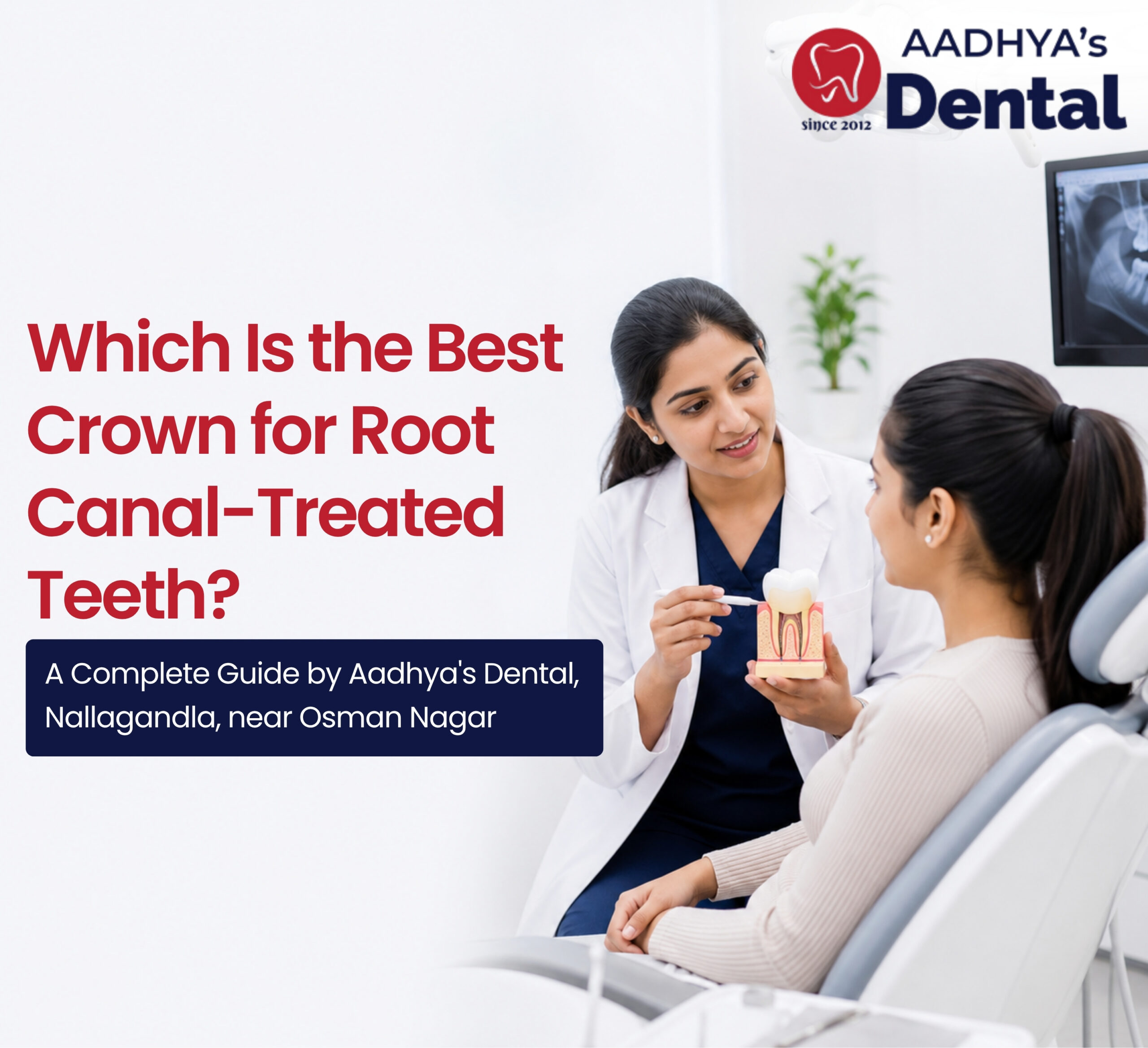 root canal crown in Nallagandla