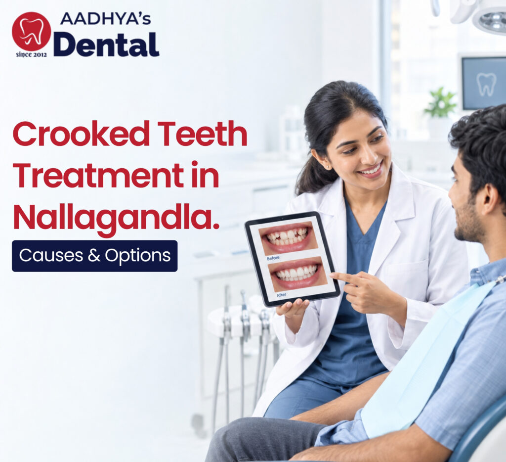 Crooked Teeth treatment in nallagandla