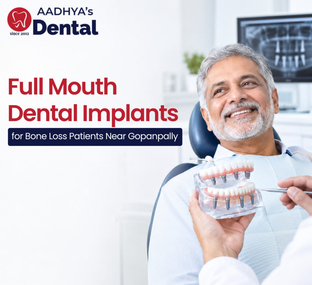 Full Mouth Dental Implants Near Gopanpally