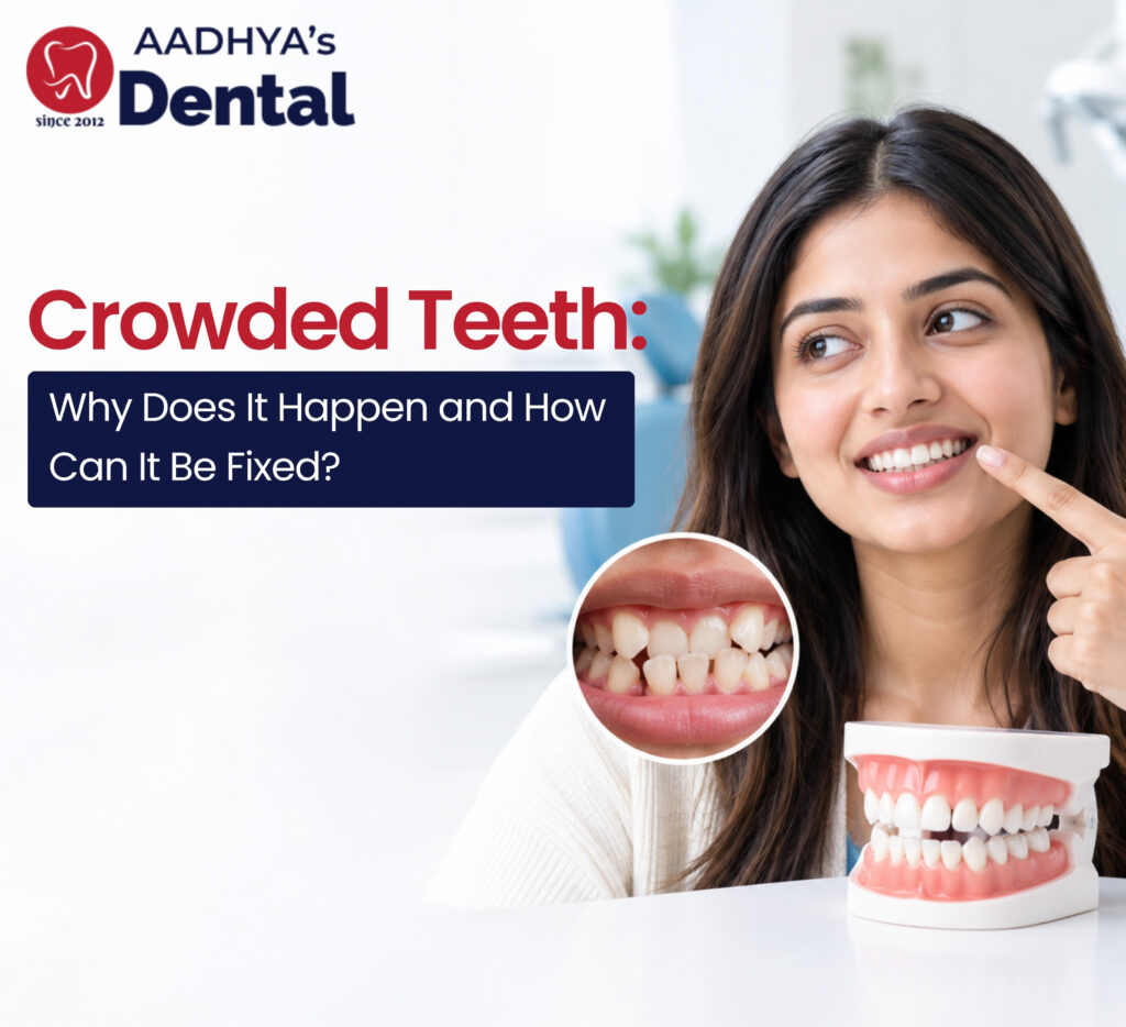 Crowded teeth treatment in nallagandla