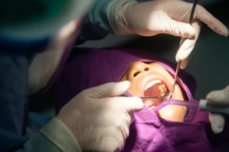 Painless Wisdom Tooth Surgeries